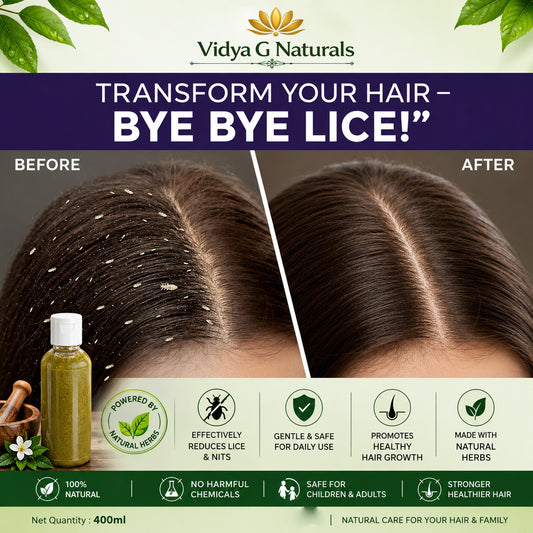 Natural Herbal Lice Shampoo - 400ML | Safe for children and adults